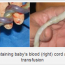 The Importance of Delayed Cord Clamping